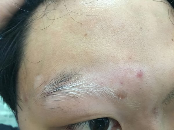 身体这处毛发变白, 暗示活得不长? 看看你白了没有